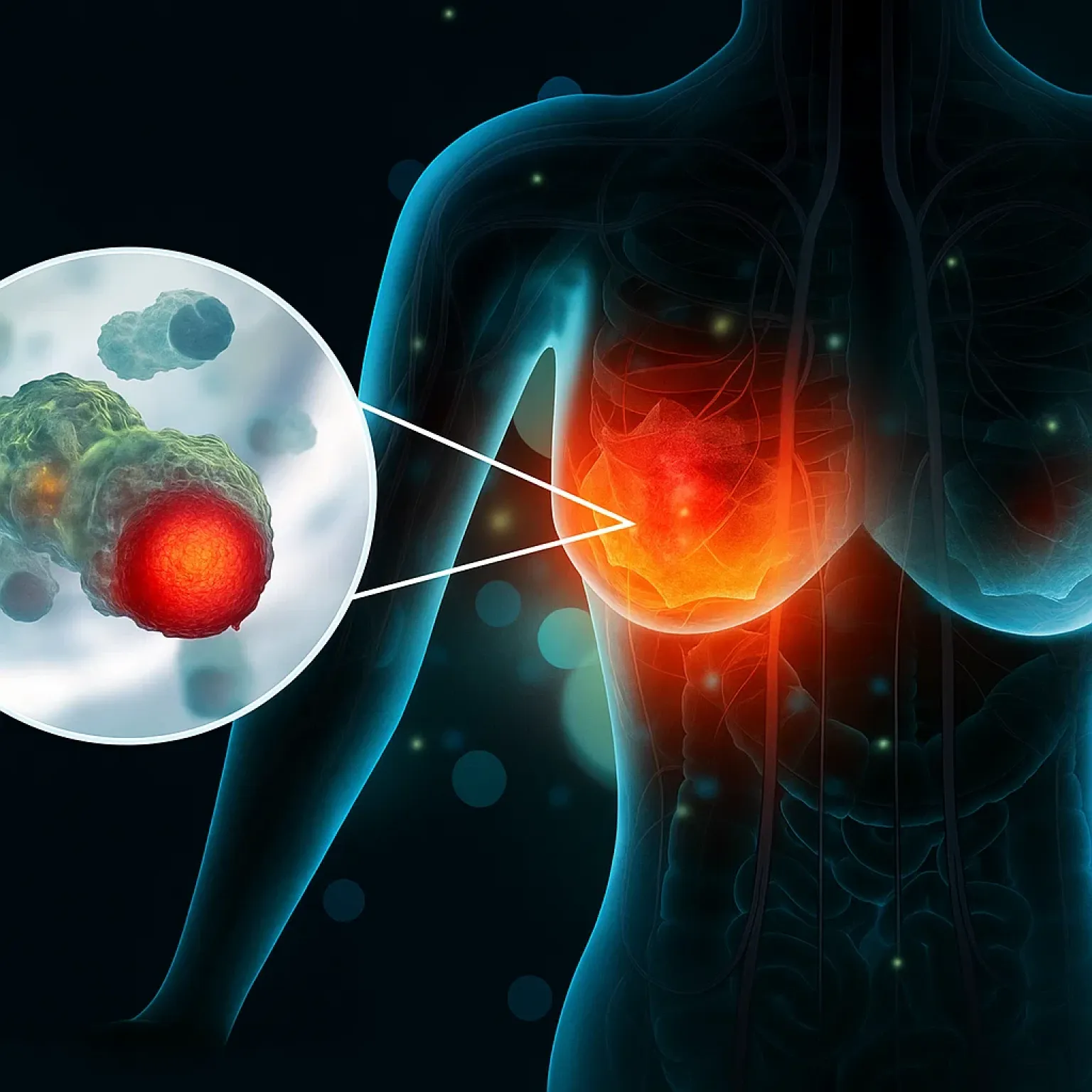 Маммология